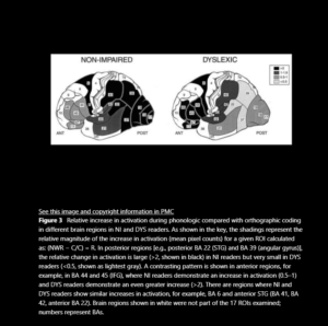 image dyslexia research figure