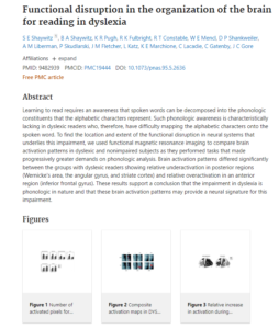 research functional brain reading in dyslexia